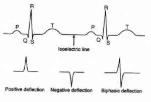 isoeletrica-300x203.webp