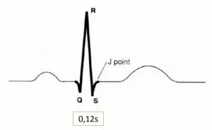 qrs-300x184.webp