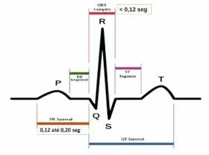 ecg_normal-300x223.webp